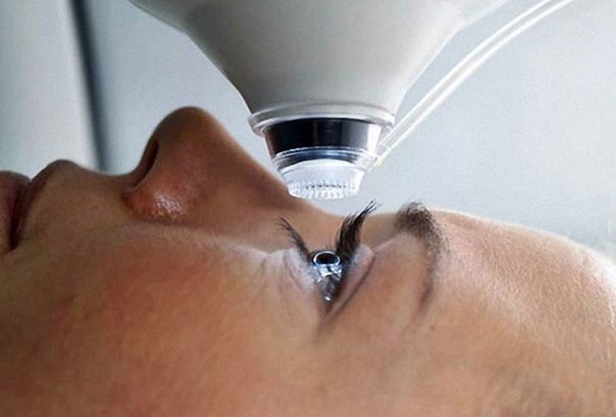 Лечение близорукости лазером