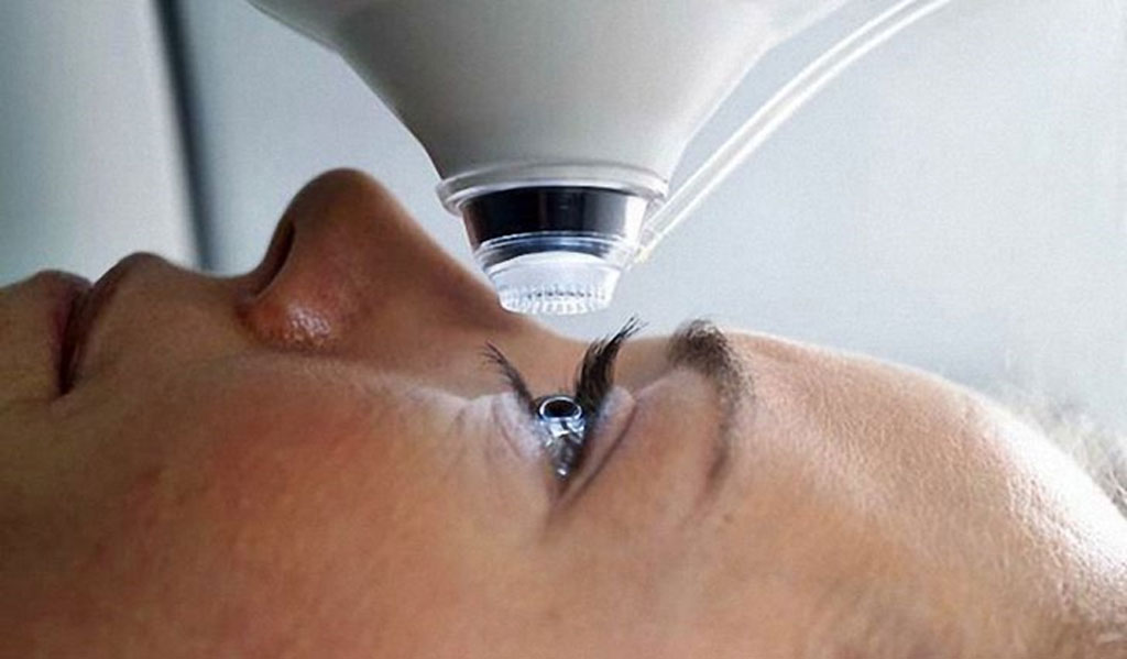 Миопия слабой степени (1 степени)