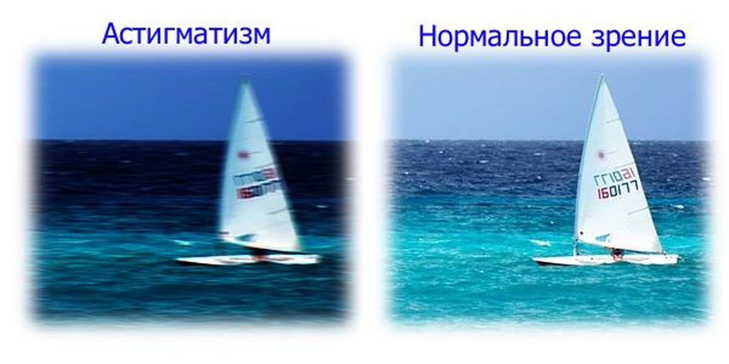 Как видят люди с астигматизмом
