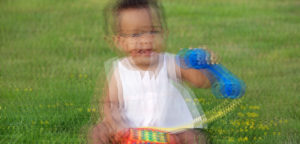 Причины диплопии после замены хрусталика