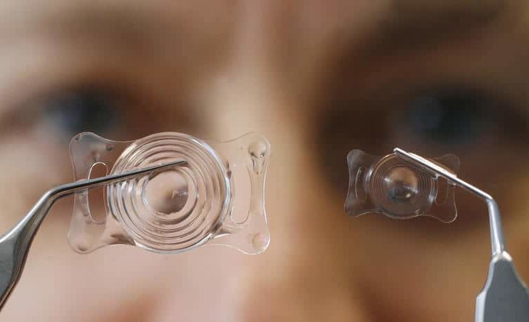 Лучшие хрусталики для глаз при катаракте