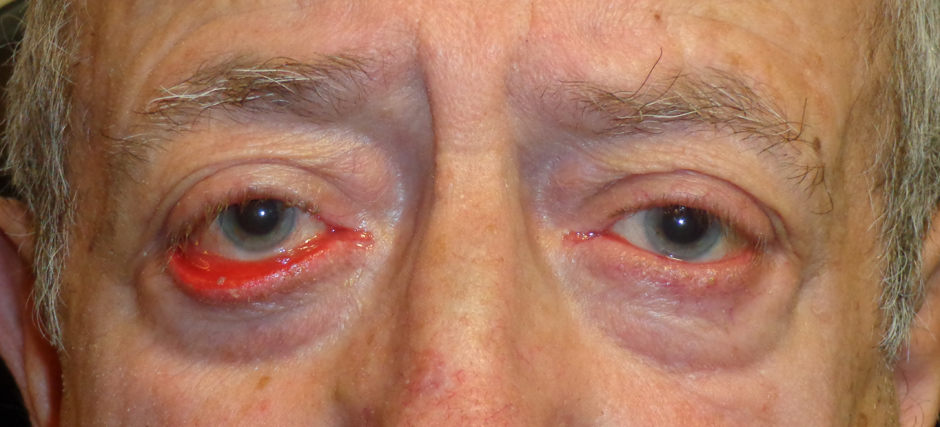 Оперативное вмешательство