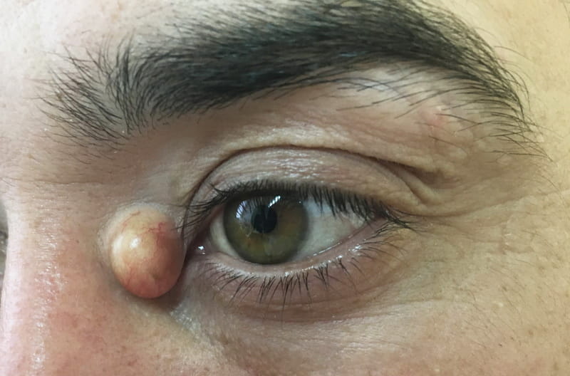 Диагностика