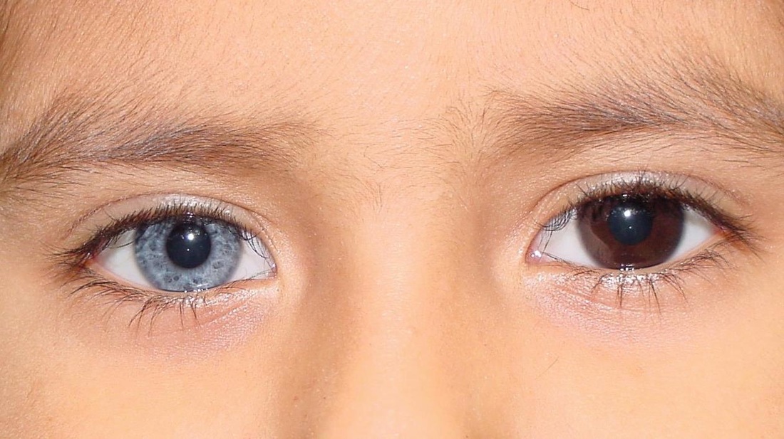 Гетерохромия