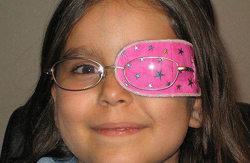 Содружественное косоглазие