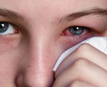 Дополнительные меры