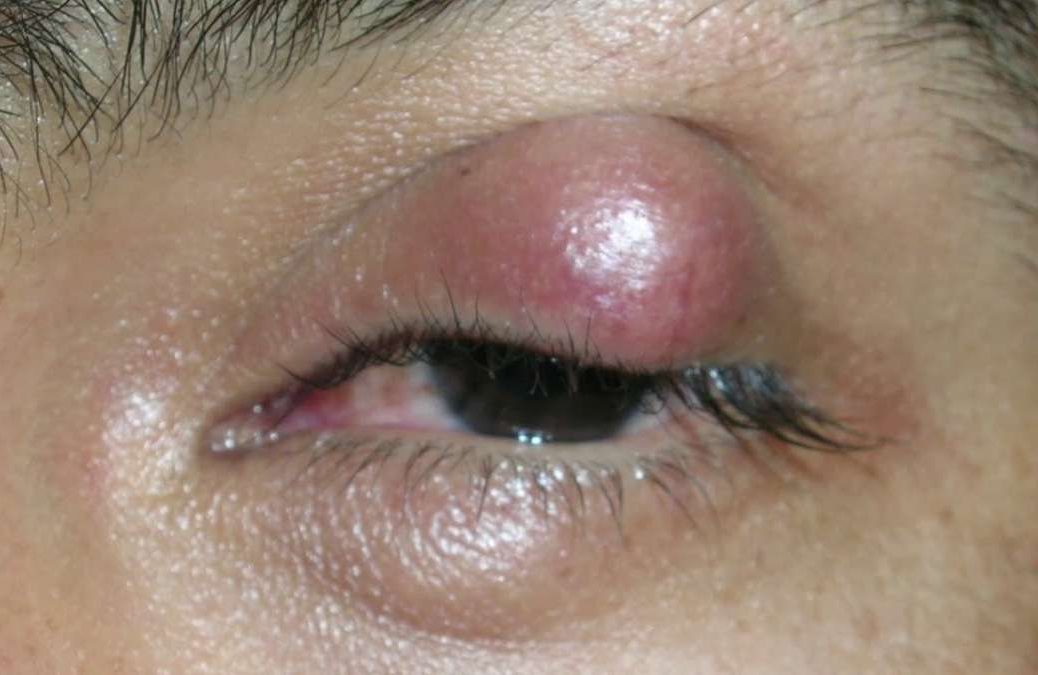 Симптоматика