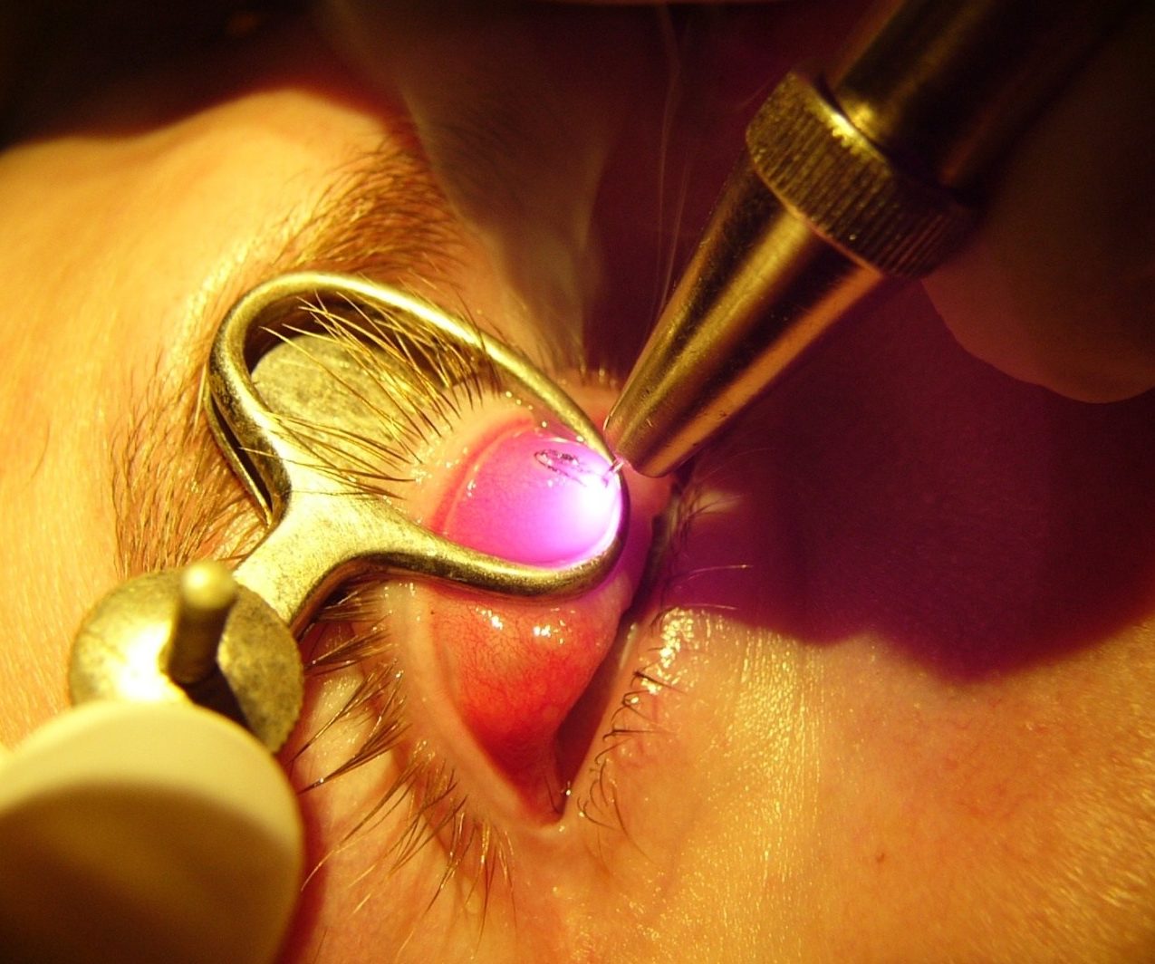 Подготовка к операции