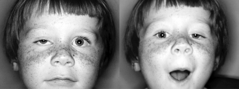 Что такое зрачок глаза