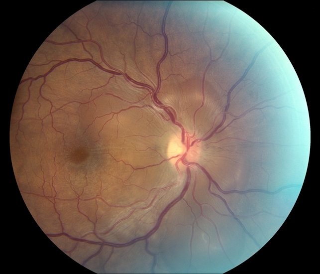 диагностика