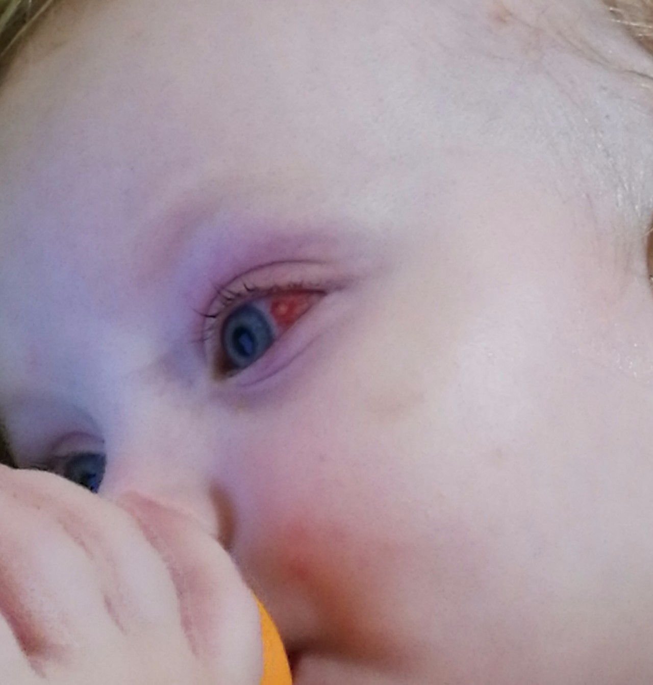 Почему у грудничка красные глаза