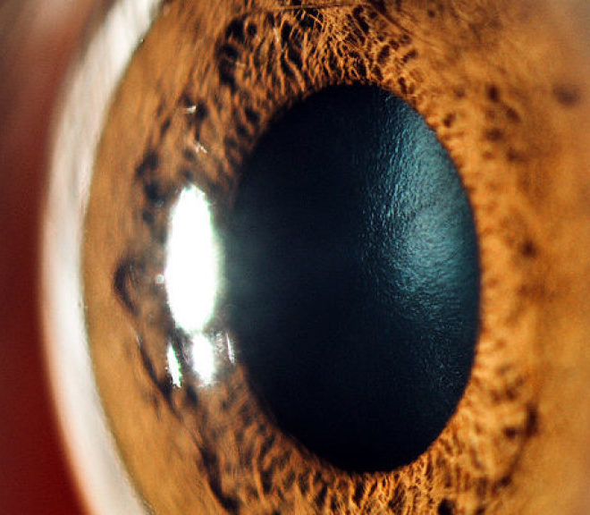 тонкая роговица