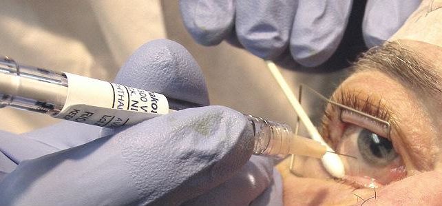 Абиотрофия сетчатки