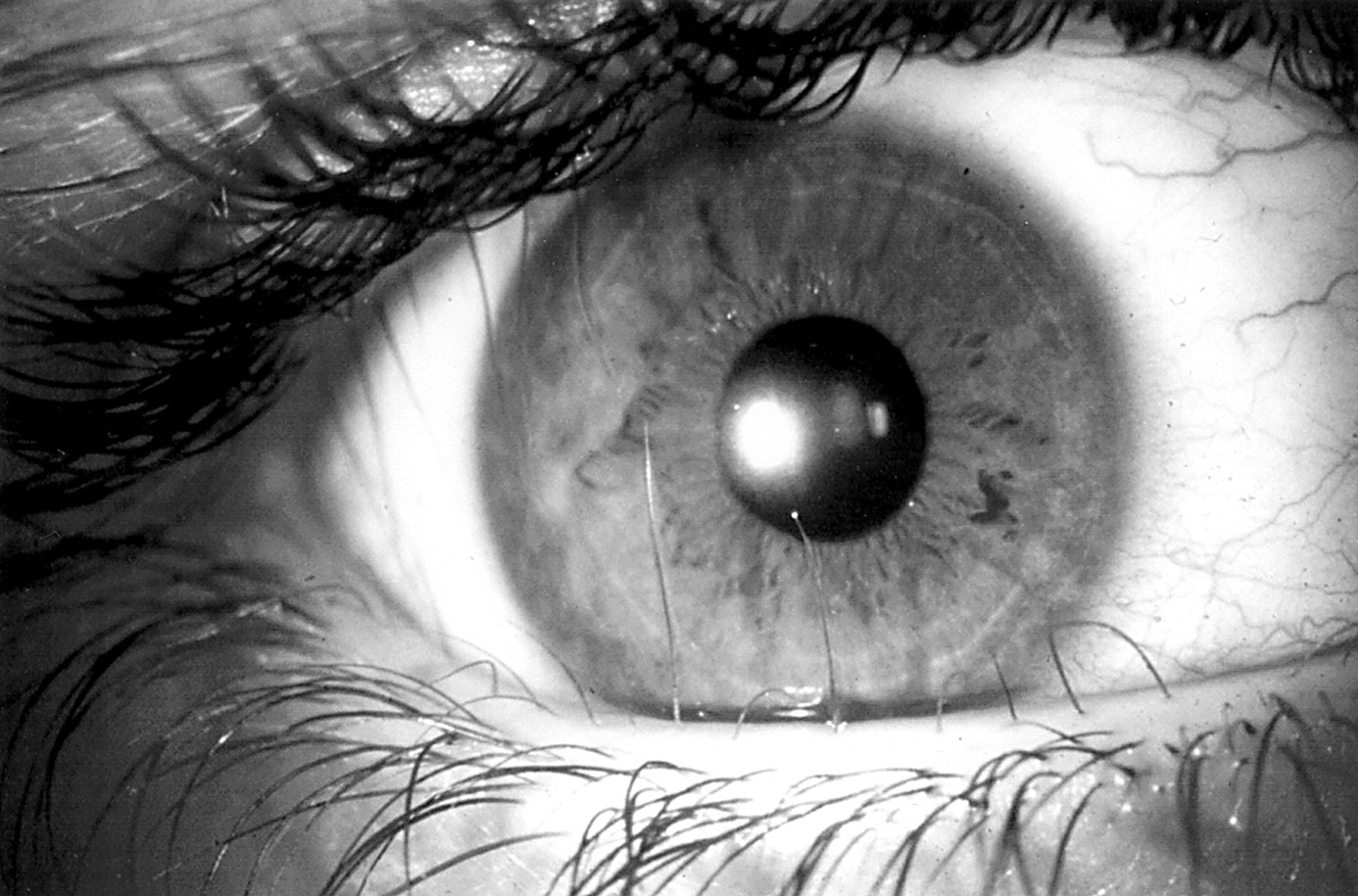 Жжение в глазах - почему глаза горят