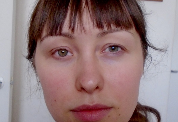 Что такое микрофтальм