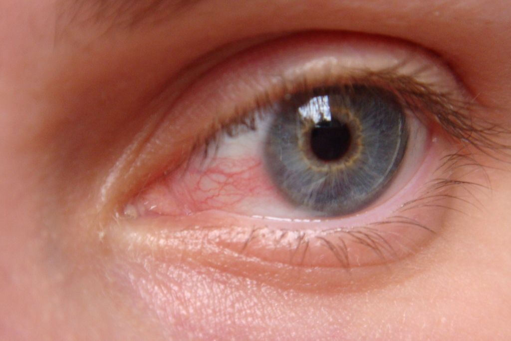 Меры предосторожности