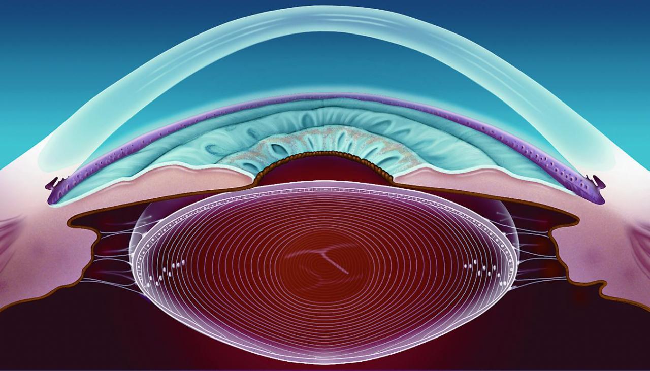 Хрусталик глаза