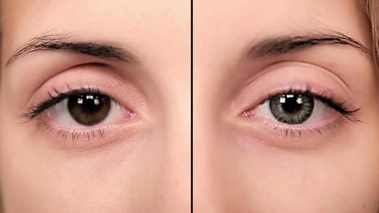 Фото изменения цвета глаз у детей