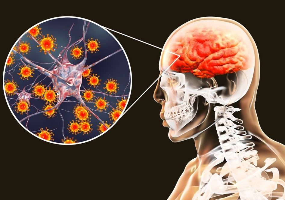 Возможные осложнения