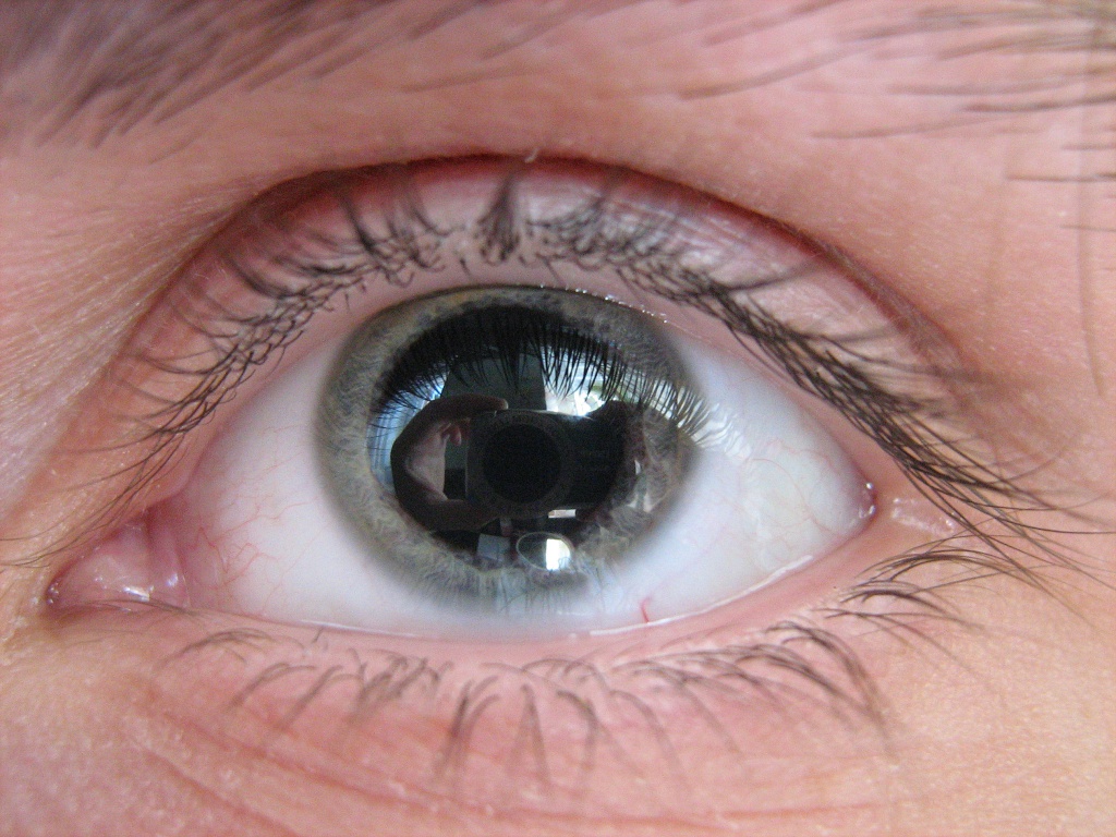 Как избавиться от расширенных зрачков