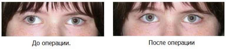 Подготовка к операции