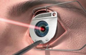 Почему ухудшается зрение после родов