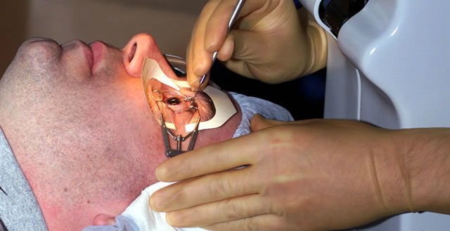 Миопия слабой степени (1 степени)