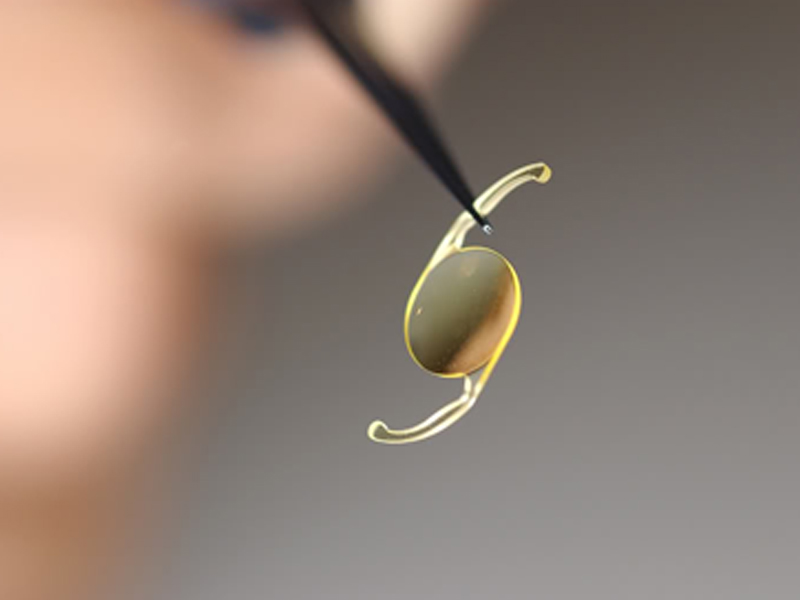 Разновидности