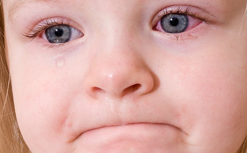 красные глаза