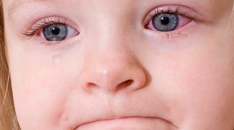 красные глаза