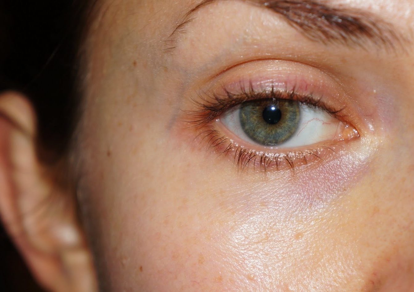 Нарушение обмена веществ