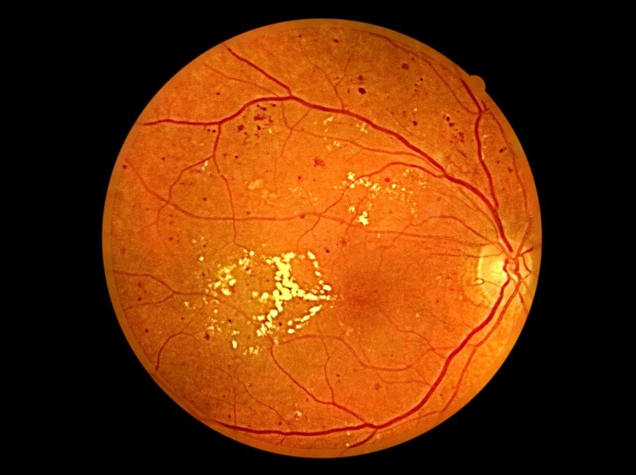 Список заболеваний глаз у человека - описание симптомов