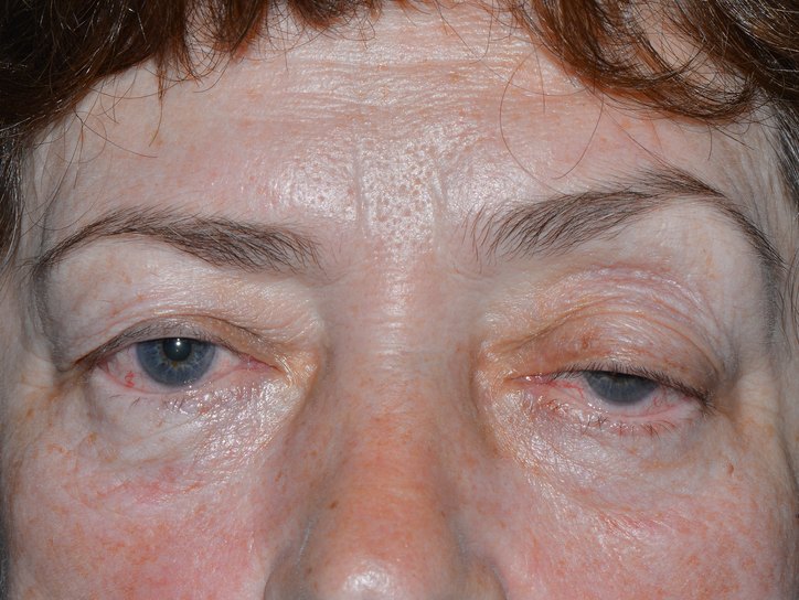 Классификация