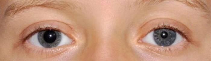 Диаметр зрачка