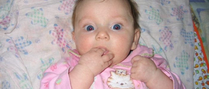 Опасные симптомы