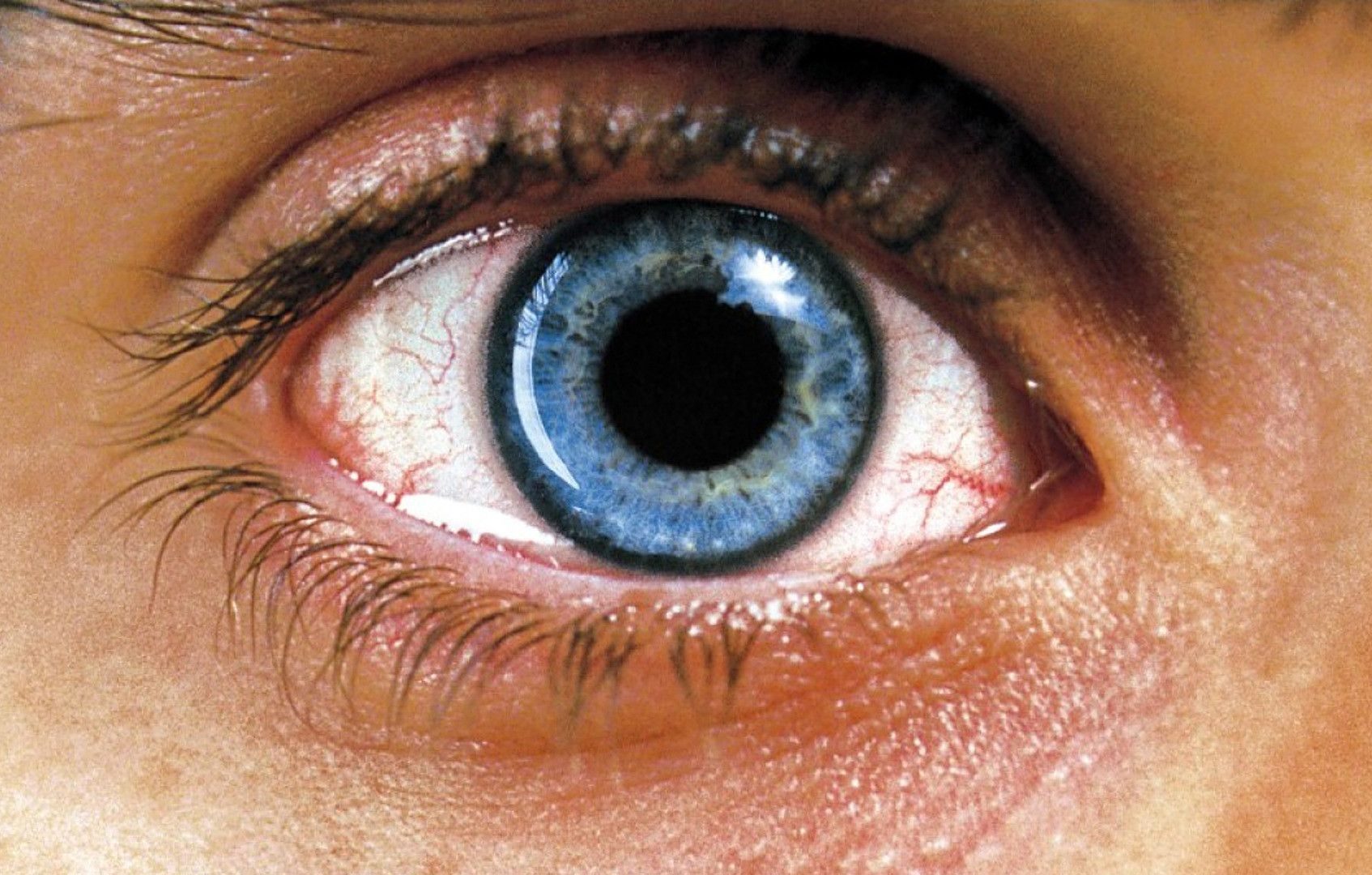 Местная терапия