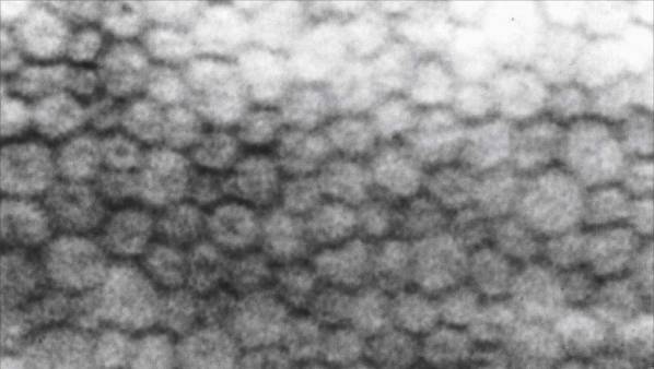 Эндотелиальная микроскопия роговицы глаза