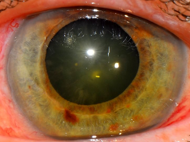 Что такое зрачок глаза