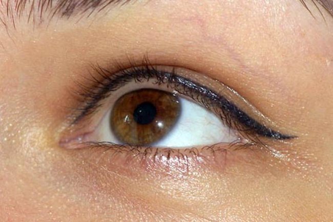 Строение век