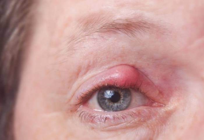 Особенности ячменя