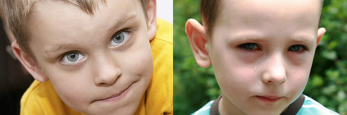 Почему у ребенка появились мешки под глазами