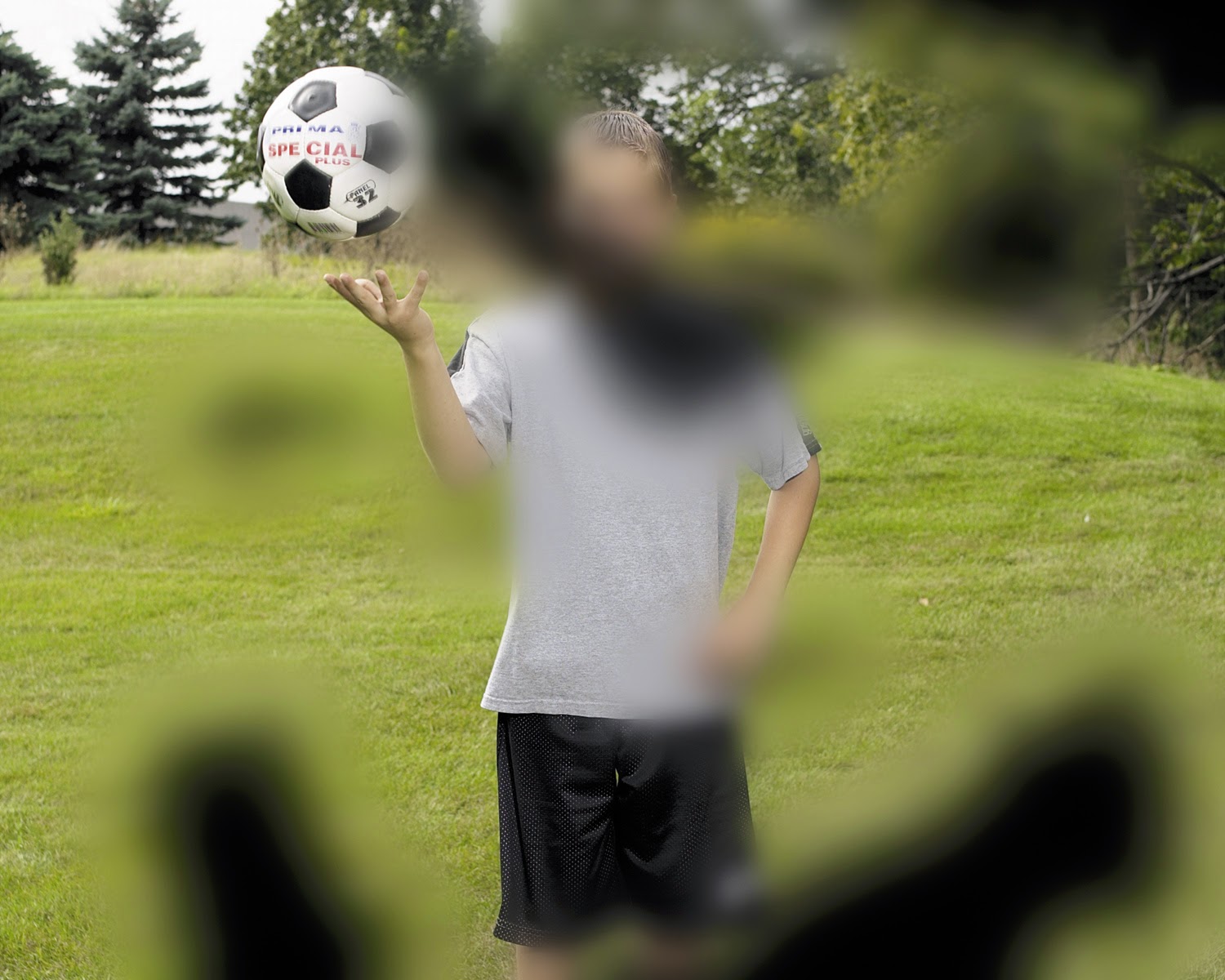 Что такое скотома глаза