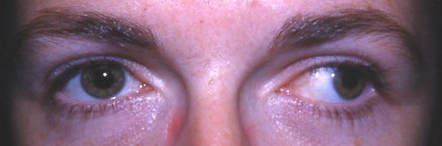 Хирургическое лечение