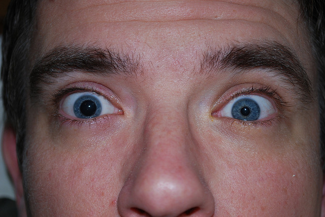 Зрачки разные по размеру