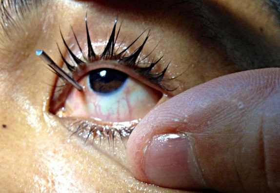 Проникающее ранение глаза