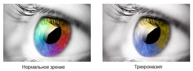 Аномальная трихромазия