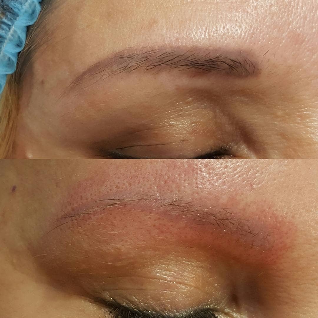 Если татуаж бровей не понравился