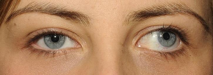 Классификация