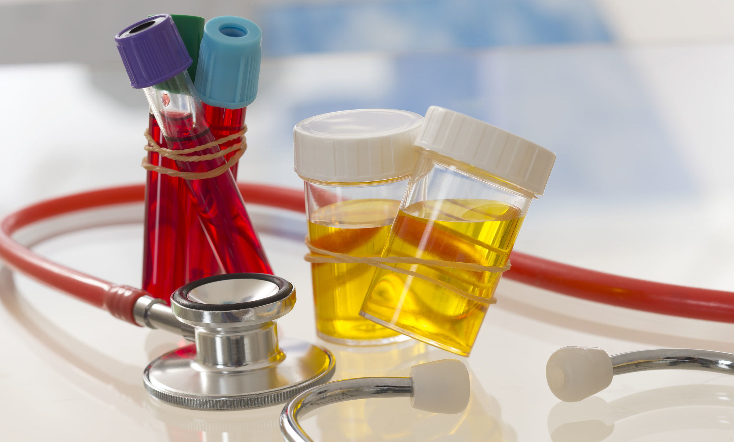 Операция катаракты - какие анализы нужны