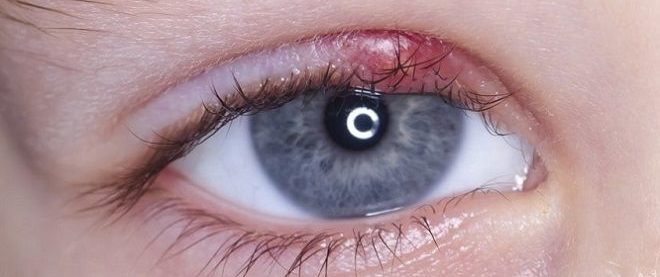 Нужен ли врач